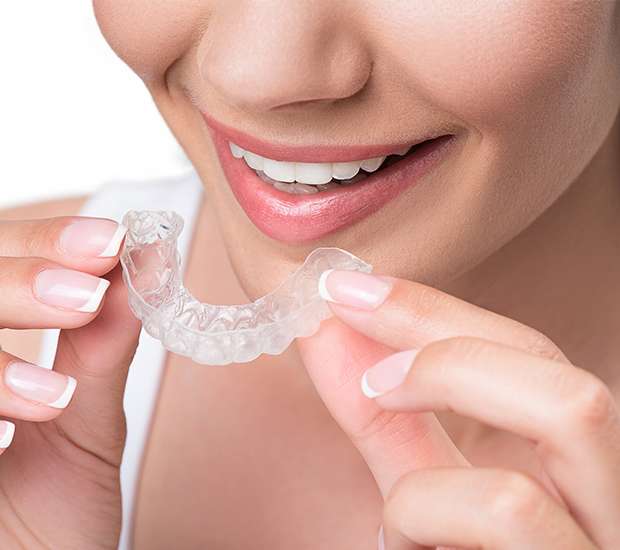 Marion Clear Aligners