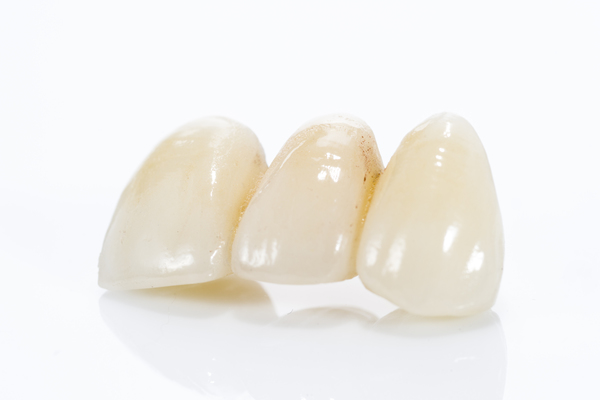 How A Dental Bridge Can Help Replace Missing Teeth