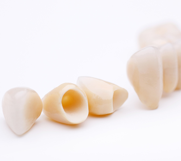 Marion Dental Crowns and Dental Bridges