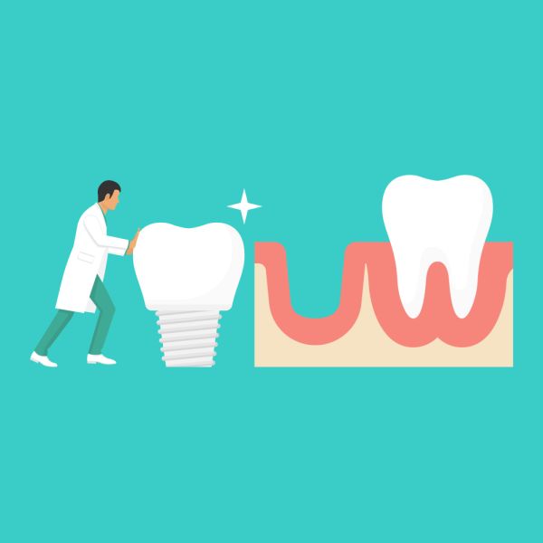 Dental Implants Marion, NC