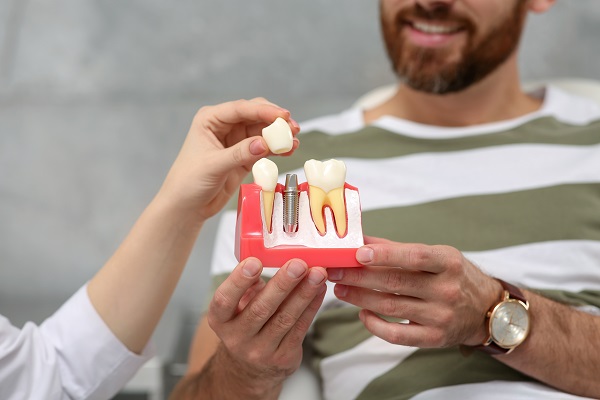 Tooth Replacement: Dentures Or Dental Implants?