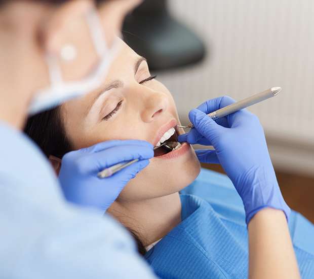Marion Dental Restorations