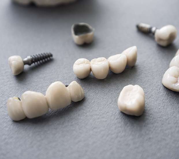 Marion The Difference Between Dental Implants and Mini Dental Implants