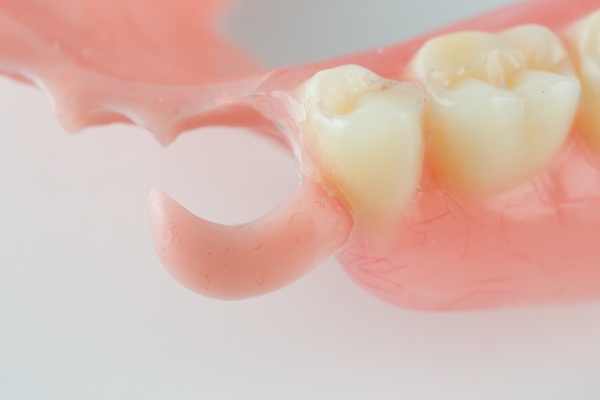 The Importance Of Partial Dentures