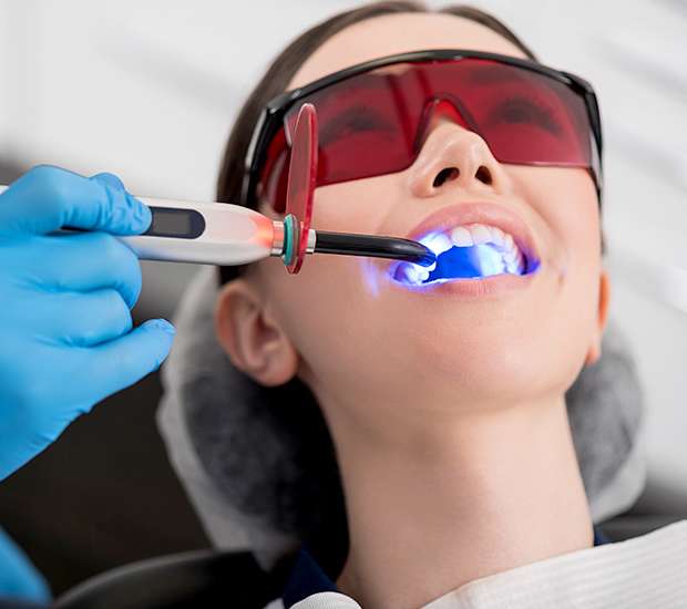 Marion Professional Teeth Whitening