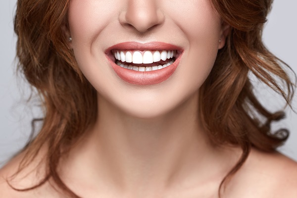 Reasons To Consider Smile Makeover Treatments